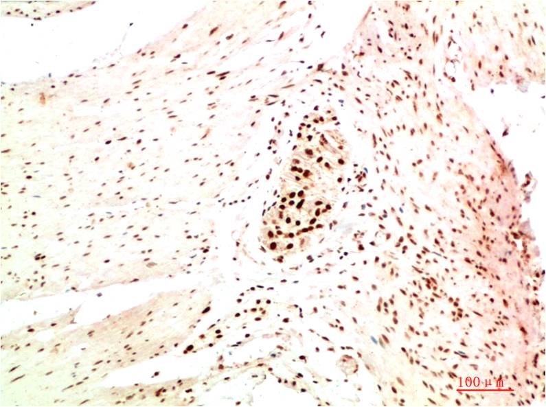 Anti-HP1 alpha (1E8) Mouse Monoclonal Antibody