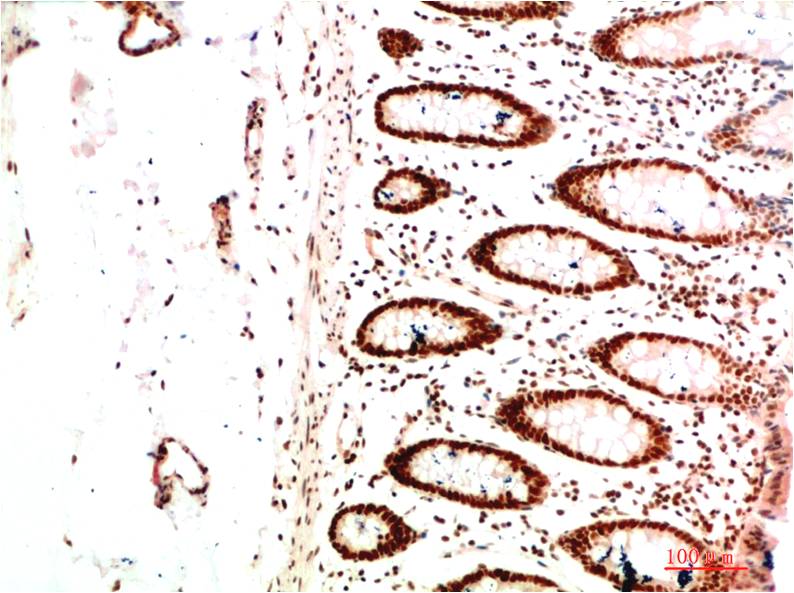 Anti-HP1 alpha (1E8) Mouse Monoclonal Antibody