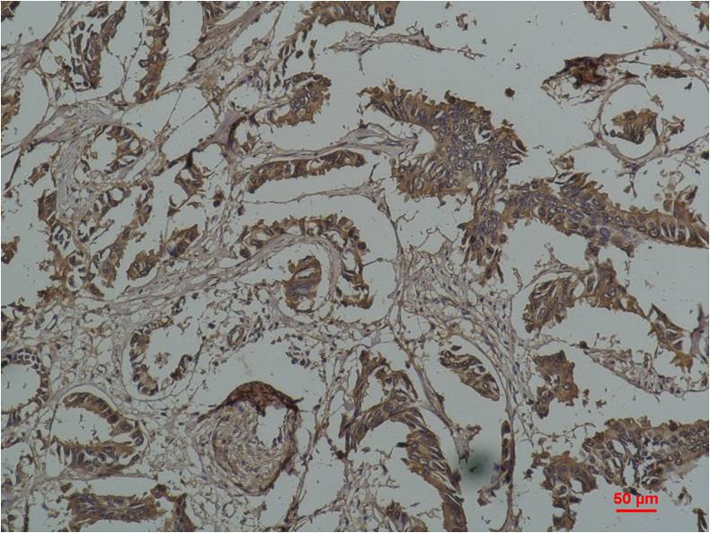 Anti-Hsp27 (9G1) Mouse Monoclonal Antibody
