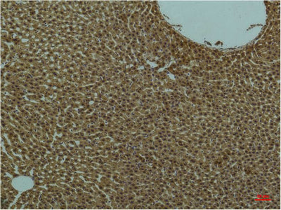 Anti-PI3 Kinase p85 alpha (3H5) Mouse Monoclonal Antibody