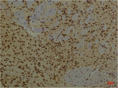Anti-PI3 Kinase p85 alpha (3H5) Mouse Monoclonal Antibody