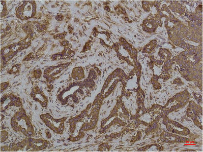 Anti-GRP78 BiP (6H7) Mouse Monoclonal Antibody