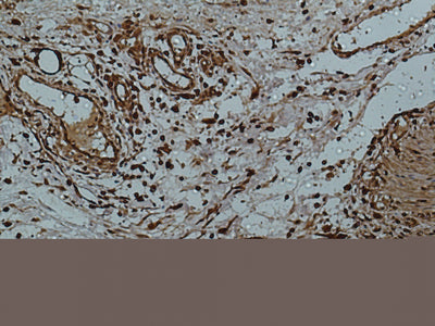 Anti-Galectin 3 (7G9) Mouse Monoclonal Antibody