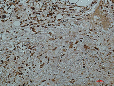 Anti-Galectin 3 (7G9) Mouse Monoclonal Antibody