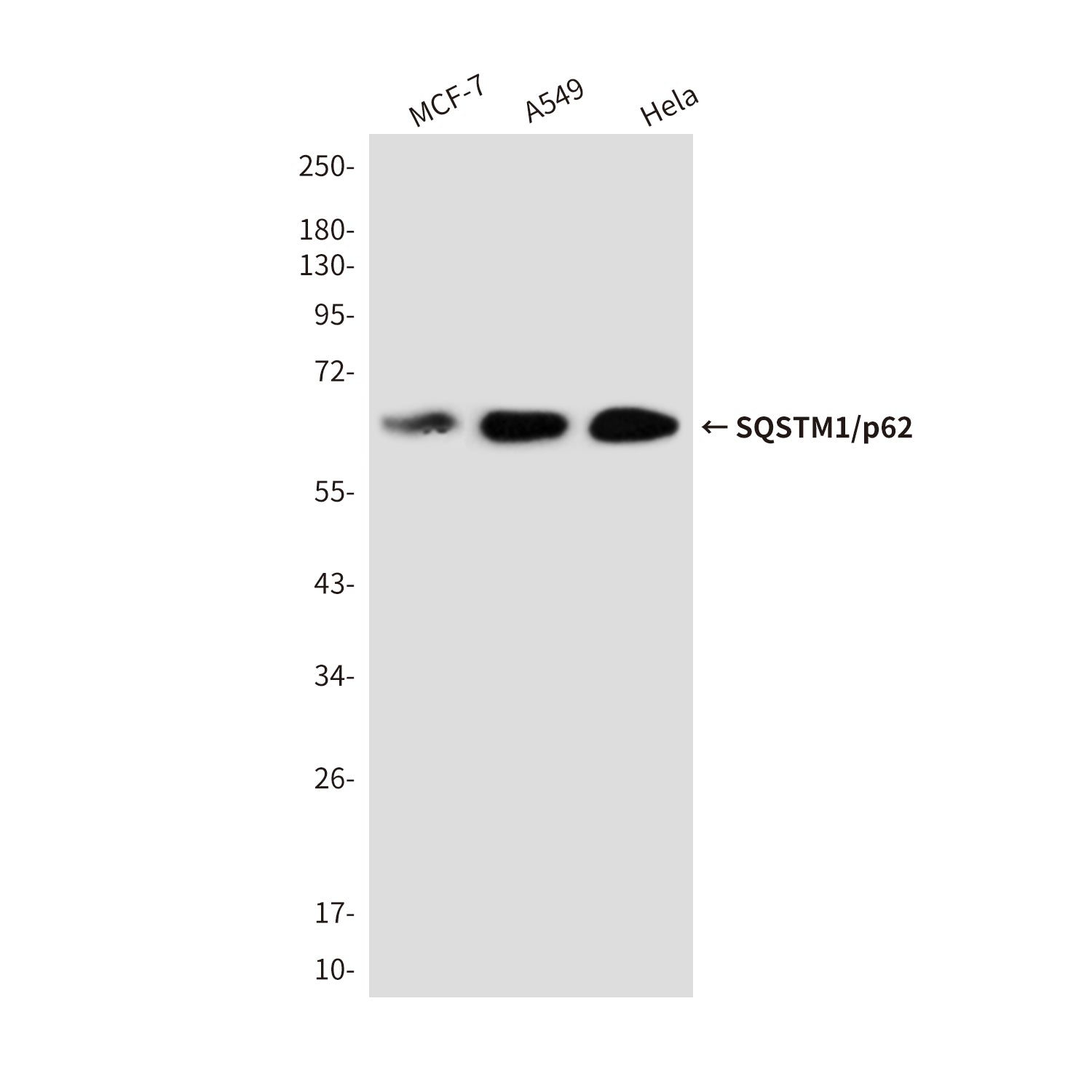 Anti-SQSTM1/p62 Rabbit Polyclonal Antibody