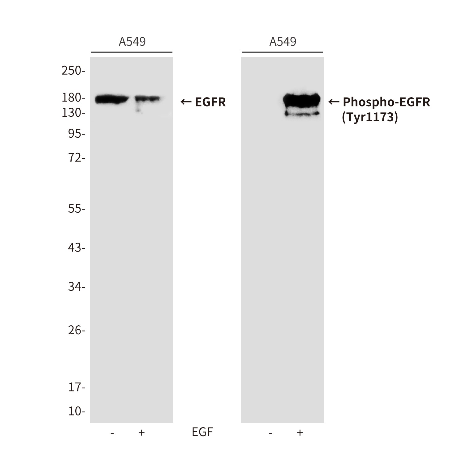 Anti-Phospho-EGFR (Tyr1173) Rabbit Polyclonal Antibody