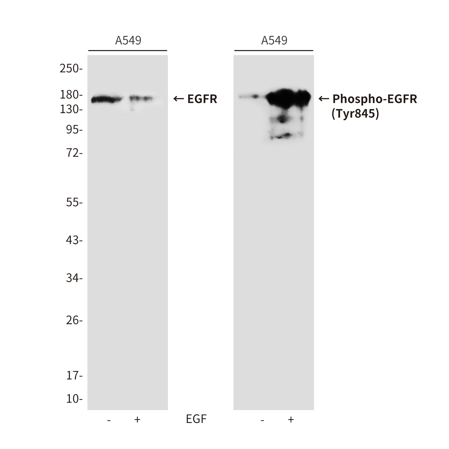 Anti-Phospho-EGFR (Tyr845) Rabbit Polyclonal Antibody