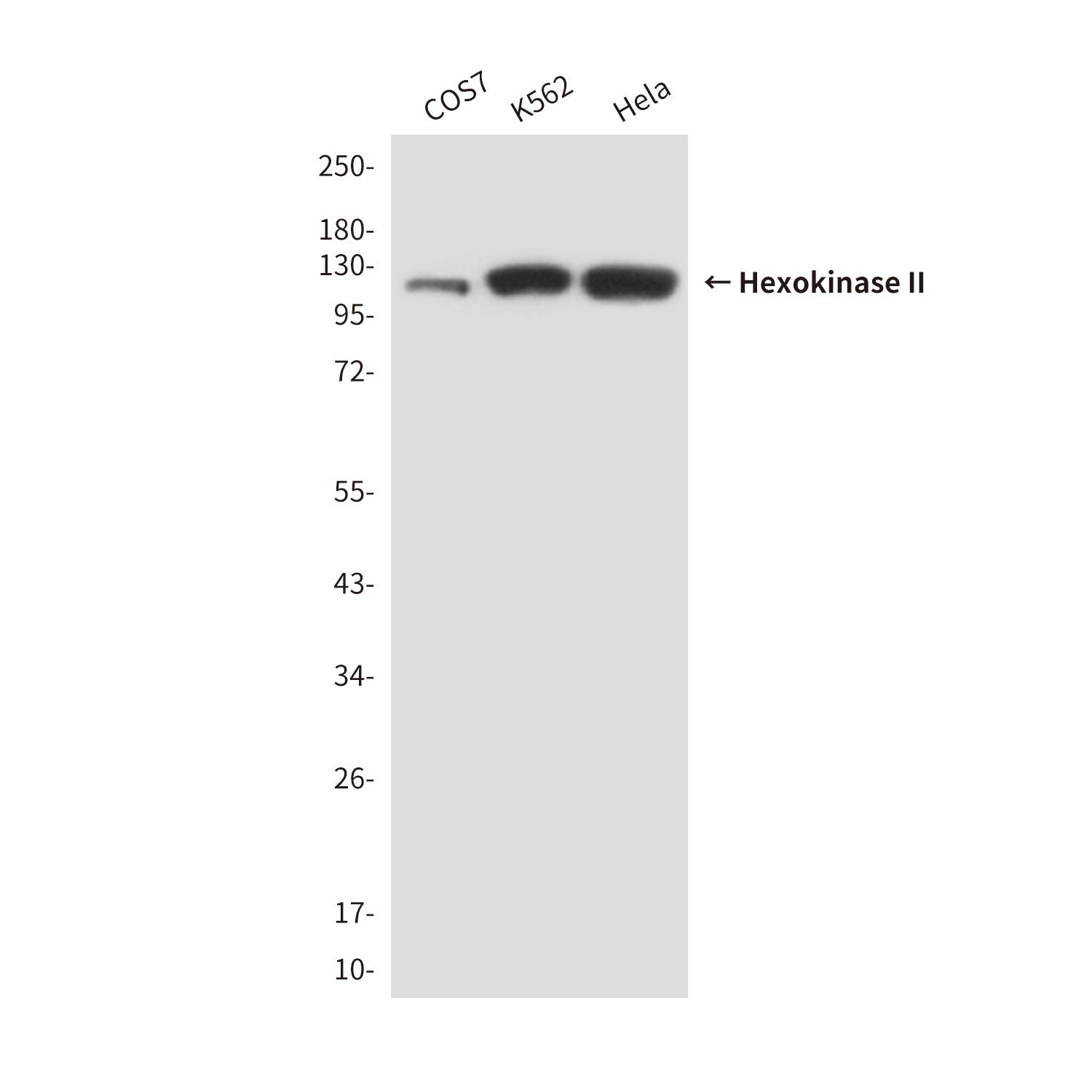 Anti-Hexokinase II (3B9) Mouse Monoclonal Antibody