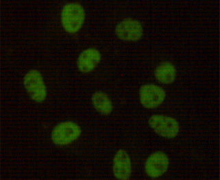 Anti-DNA PKcs (6D1) Mouse Monoclonal Antibody
