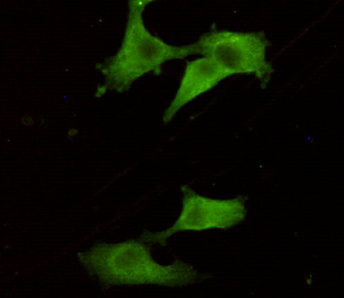 Anti-PGP9.5 (7B8G5E7) Mouse Monoclonal Antibody