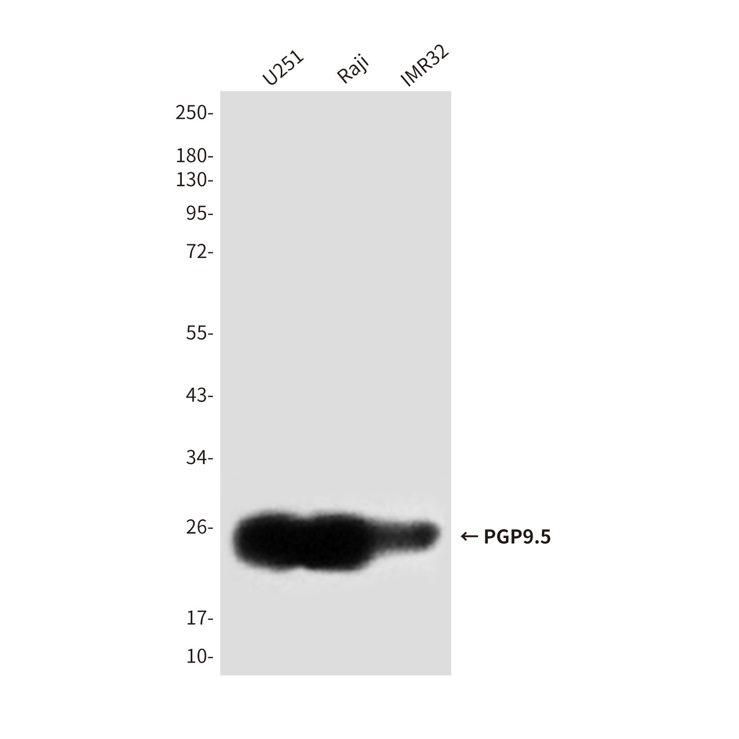 Anti-PGP9.5 (7B8G5E7) Mouse Monoclonal Antibody