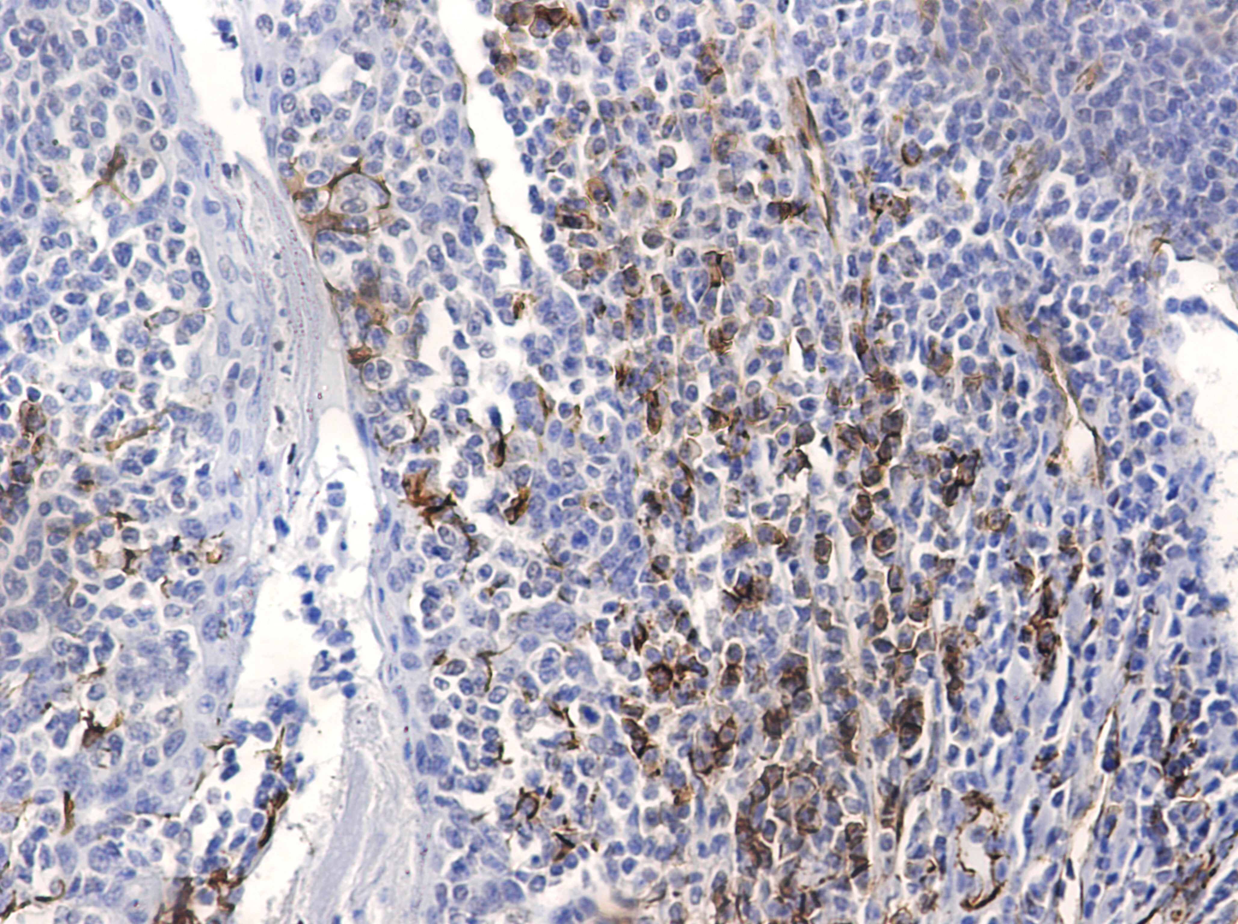 Anti-CD31 (5E2) Mouse Monoclonal Antibody
