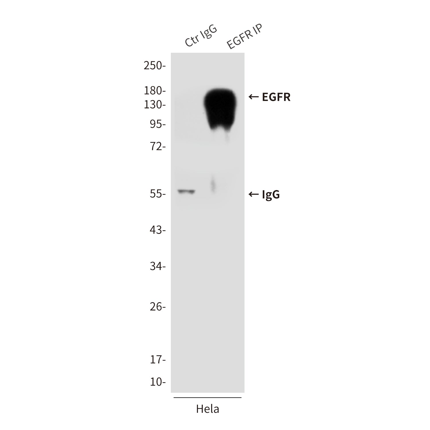 Anti-EGFR (5E10) Mouse Monoclonal Antibody