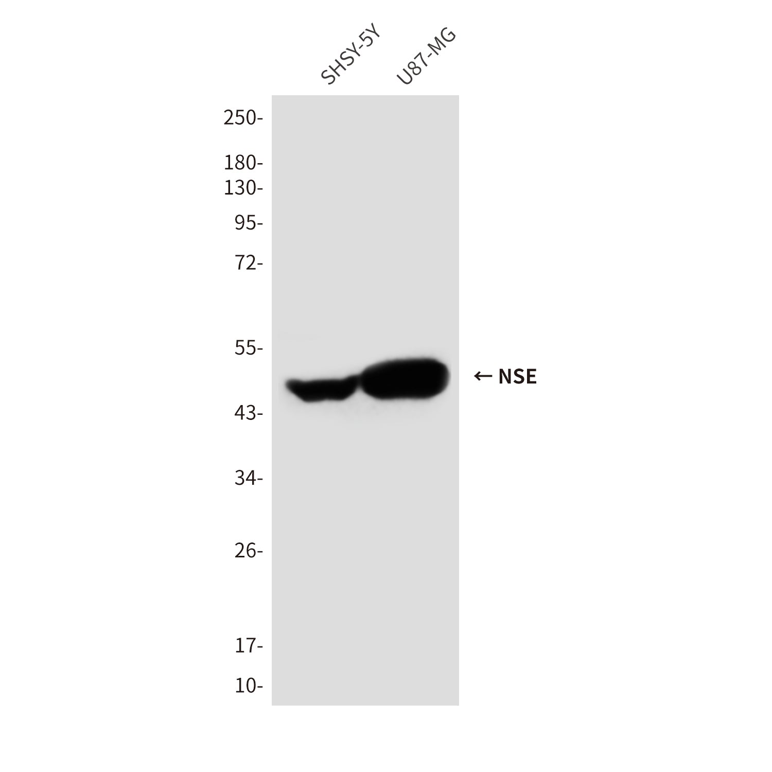 Anti-NSE (1G7) Mouse Monoclonal Antibody