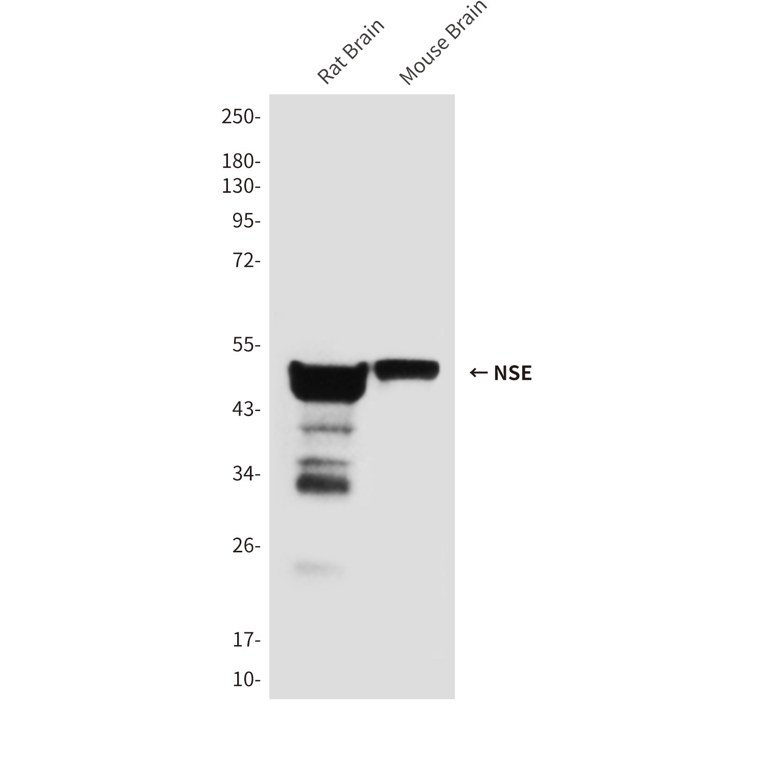 Anti-NSE (1G7) Mouse Monoclonal Antibody