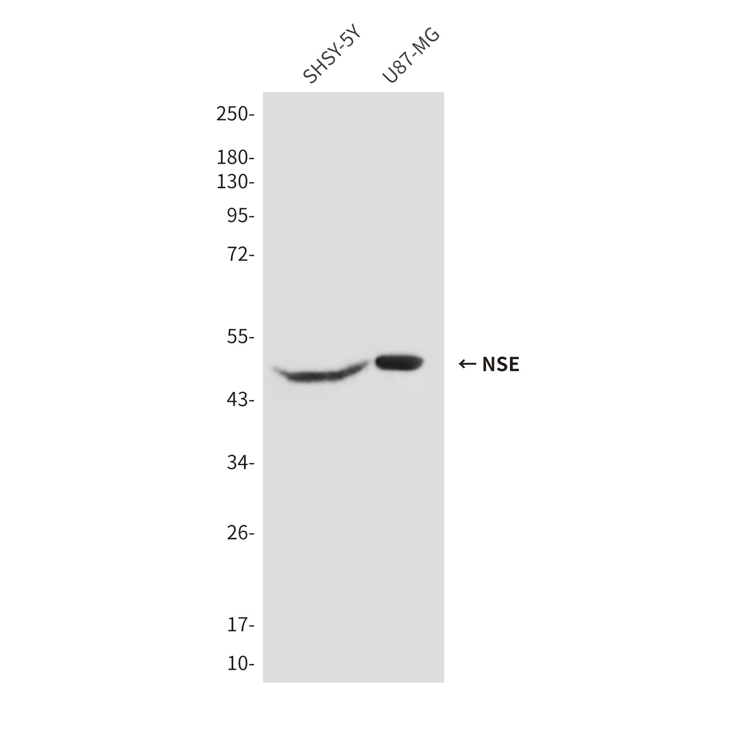 Anti-NSE (1H8) Mouse Monoclonal Antibody