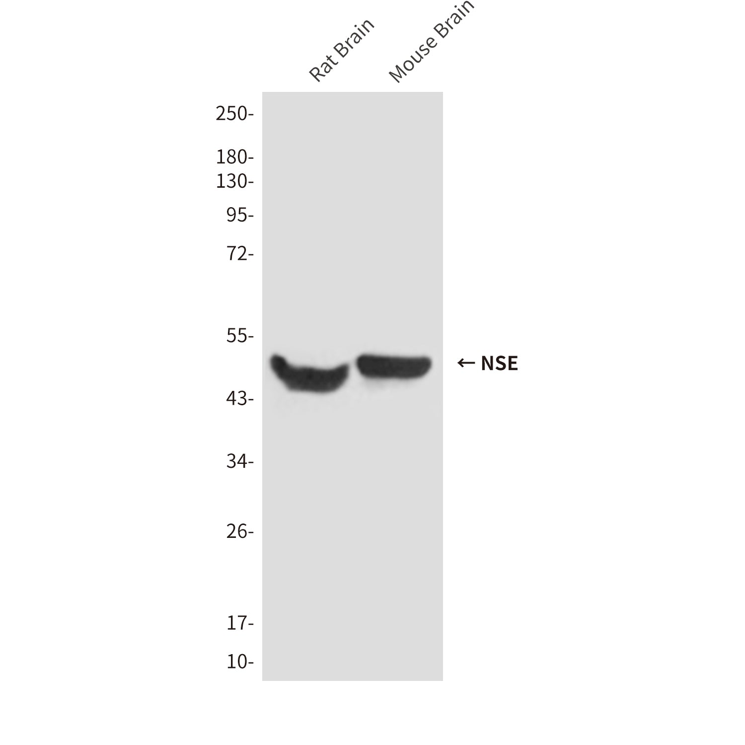 Anti-NSE (1H8) Mouse Monoclonal Antibody