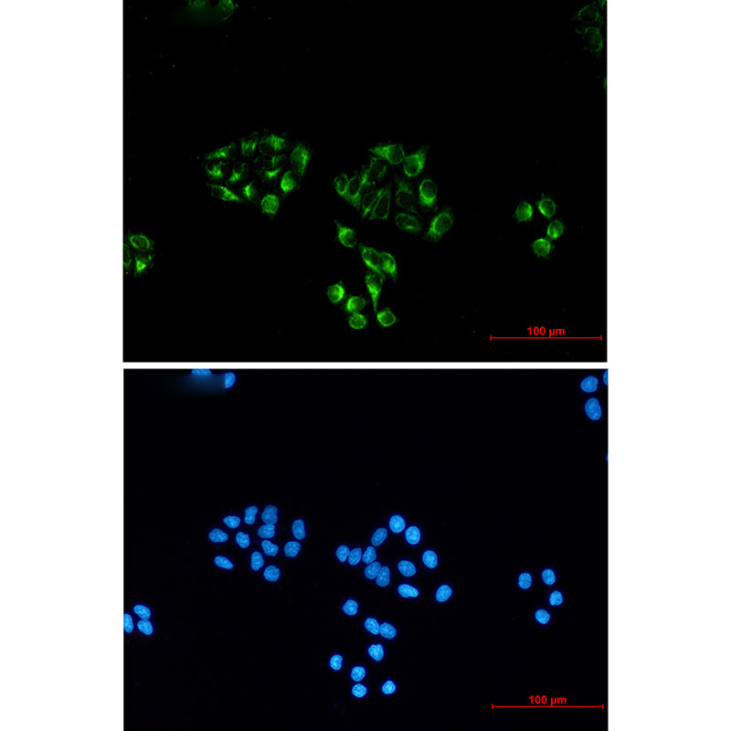 Anti-NSE (4C7) Mouse Monoclonal Antibody