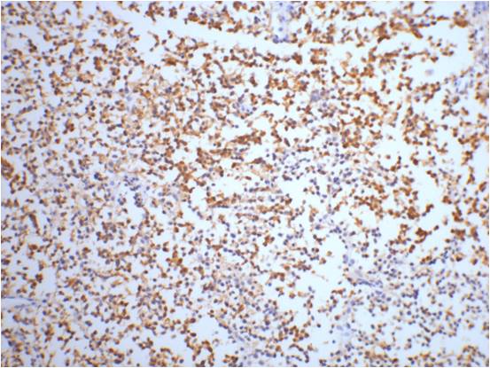 Anti-NSE (4C7) Mouse Monoclonal Antibody
