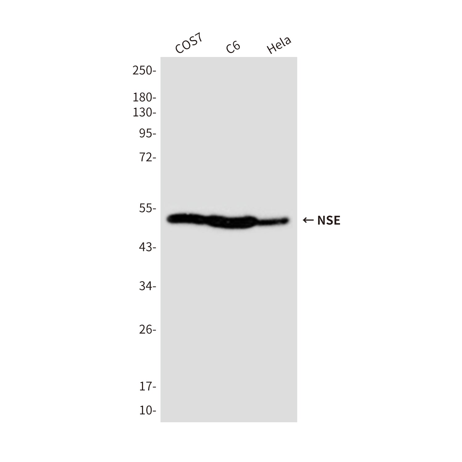 Anti-NSE (4C7) Mouse Monoclonal Antibody