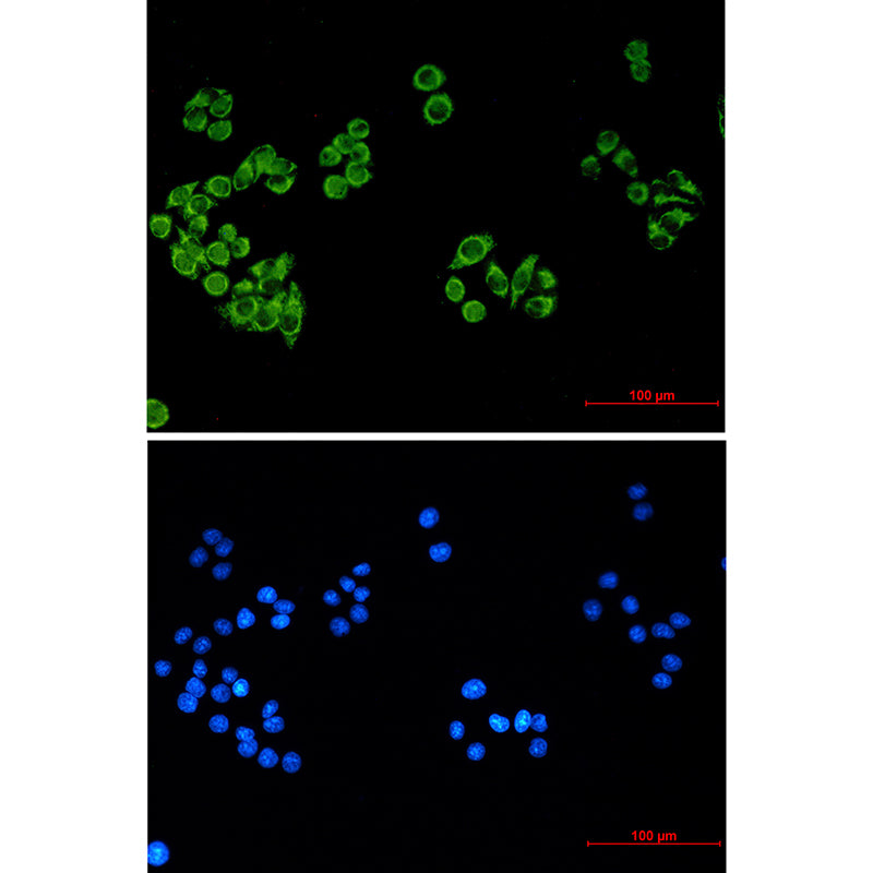Anti-FH (9B1) Mouse Monoclonal Antibody