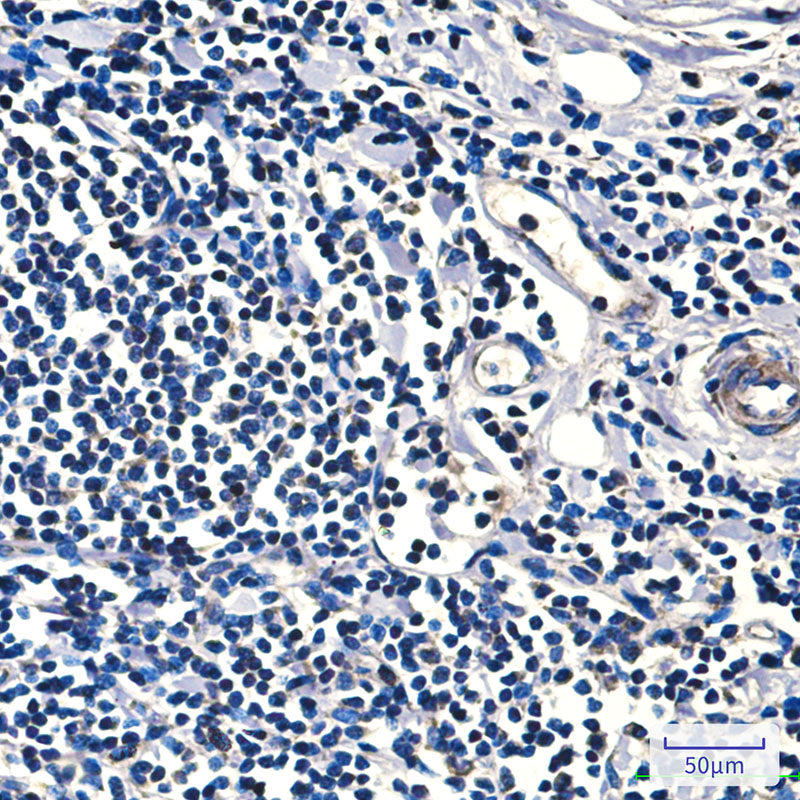 Anti-FH (9B1) Mouse Monoclonal Antibody