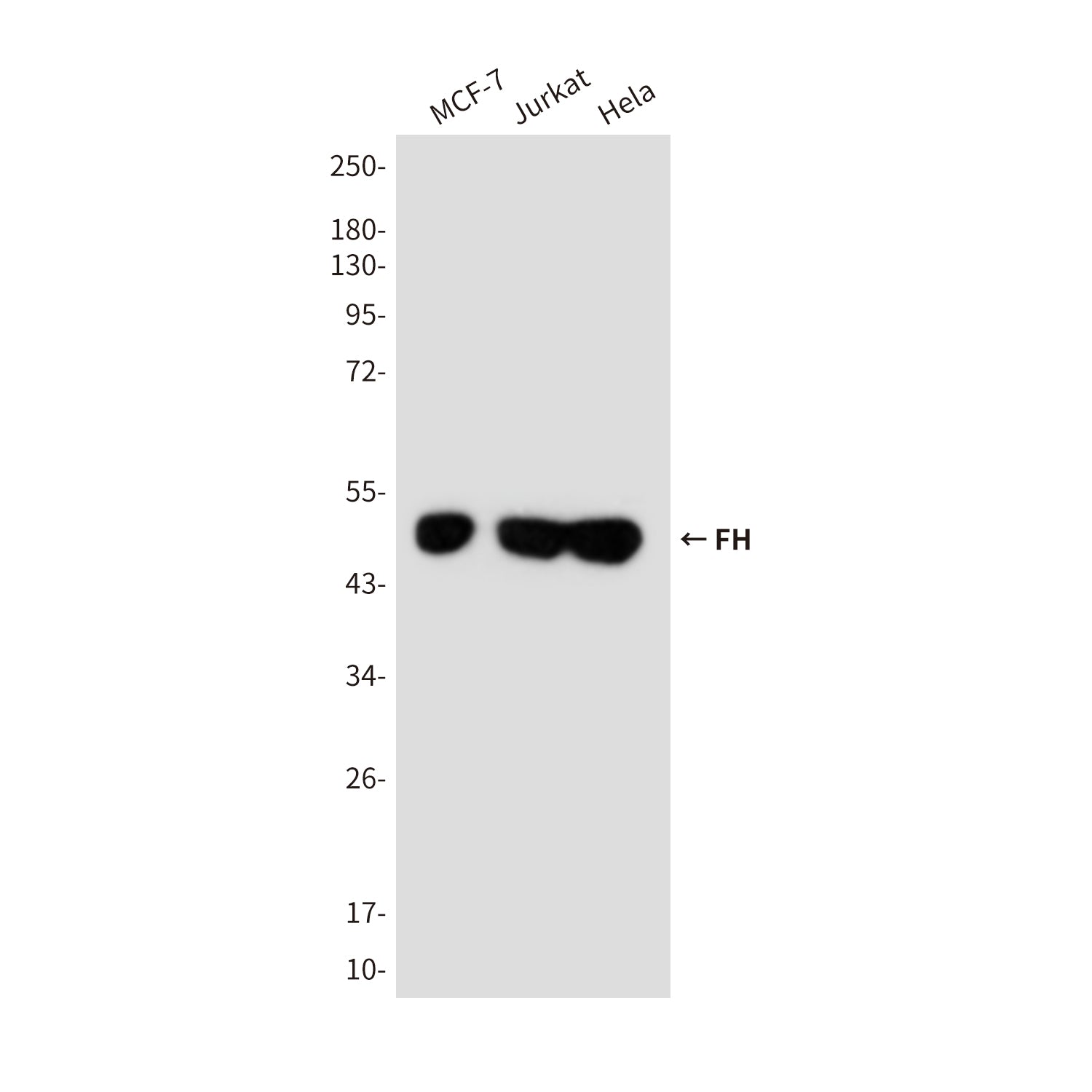 Anti-FH (9B1) Mouse Monoclonal Antibody