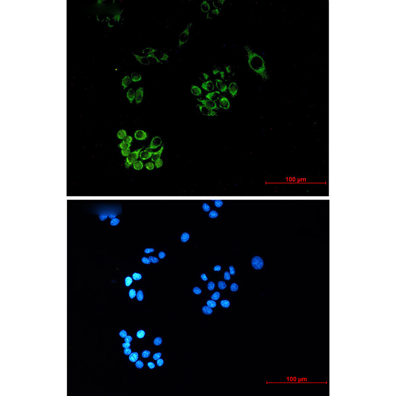 Anti-FH (2A3) Mouse Monoclonal Antibody