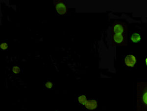 Anti-AMACR (2F3) Mouse Monoclonal Antibody