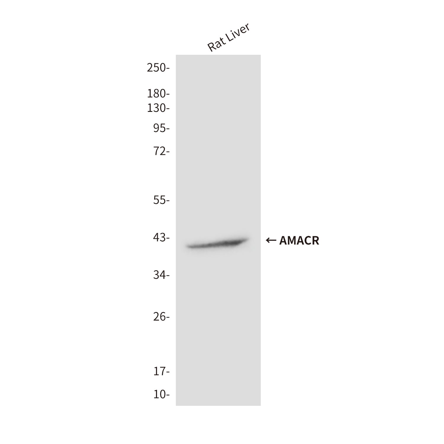 Anti-AMACR (2F3) Mouse Monoclonal Antibody