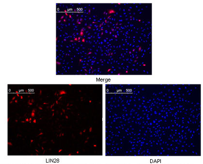 Anti-LIN28A (9G2) Mouse Monoclonal Antibody