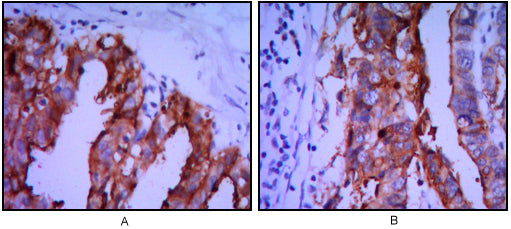 Anti-Placental Alkaline Phosphatase Mouse Monoclonal Antibody