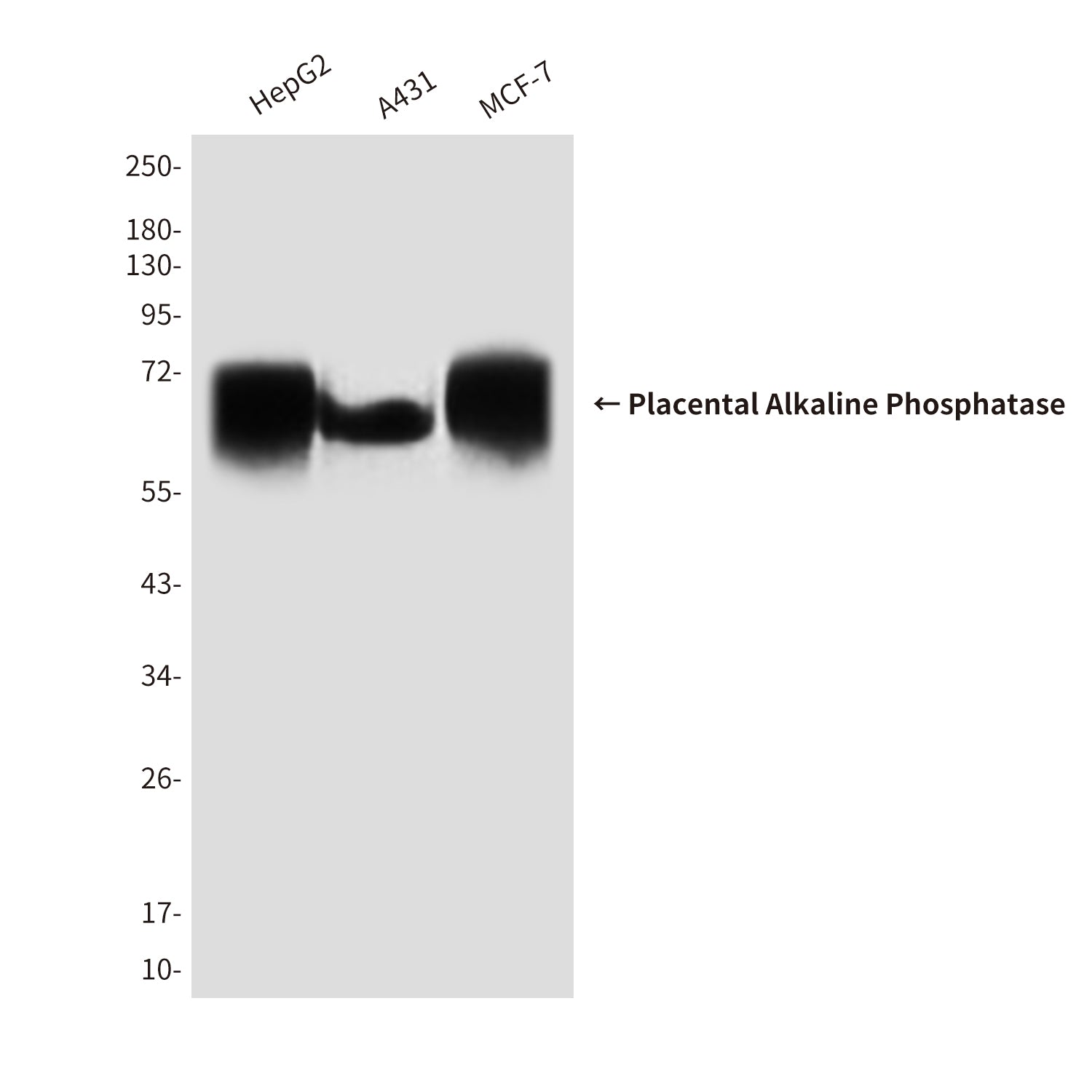 Anti-Placental Alkaline Phosphatase Mouse Monoclonal Antibody