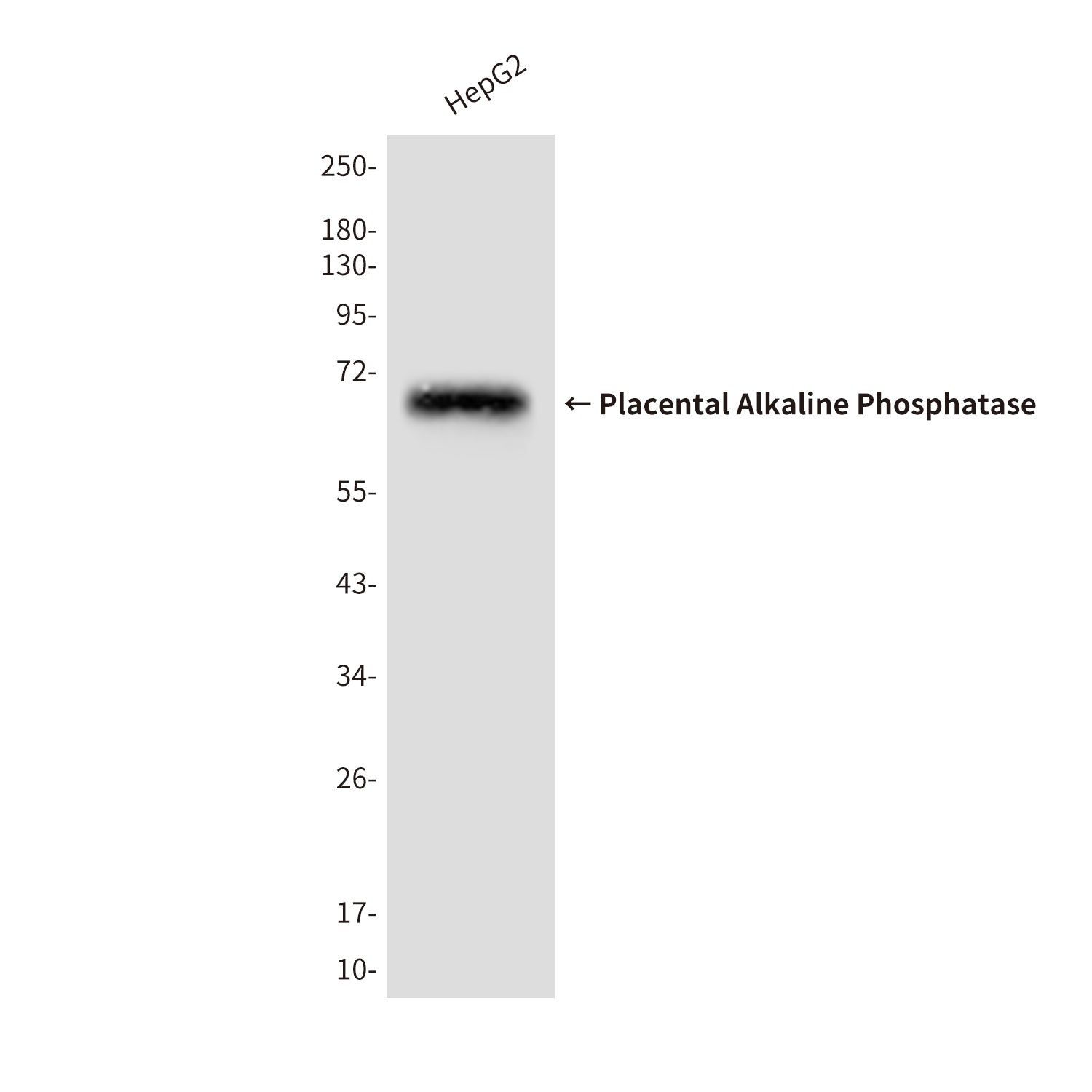 Anti-Placental Alkaline Phosphatase Mouse Monoclonal Antibody
