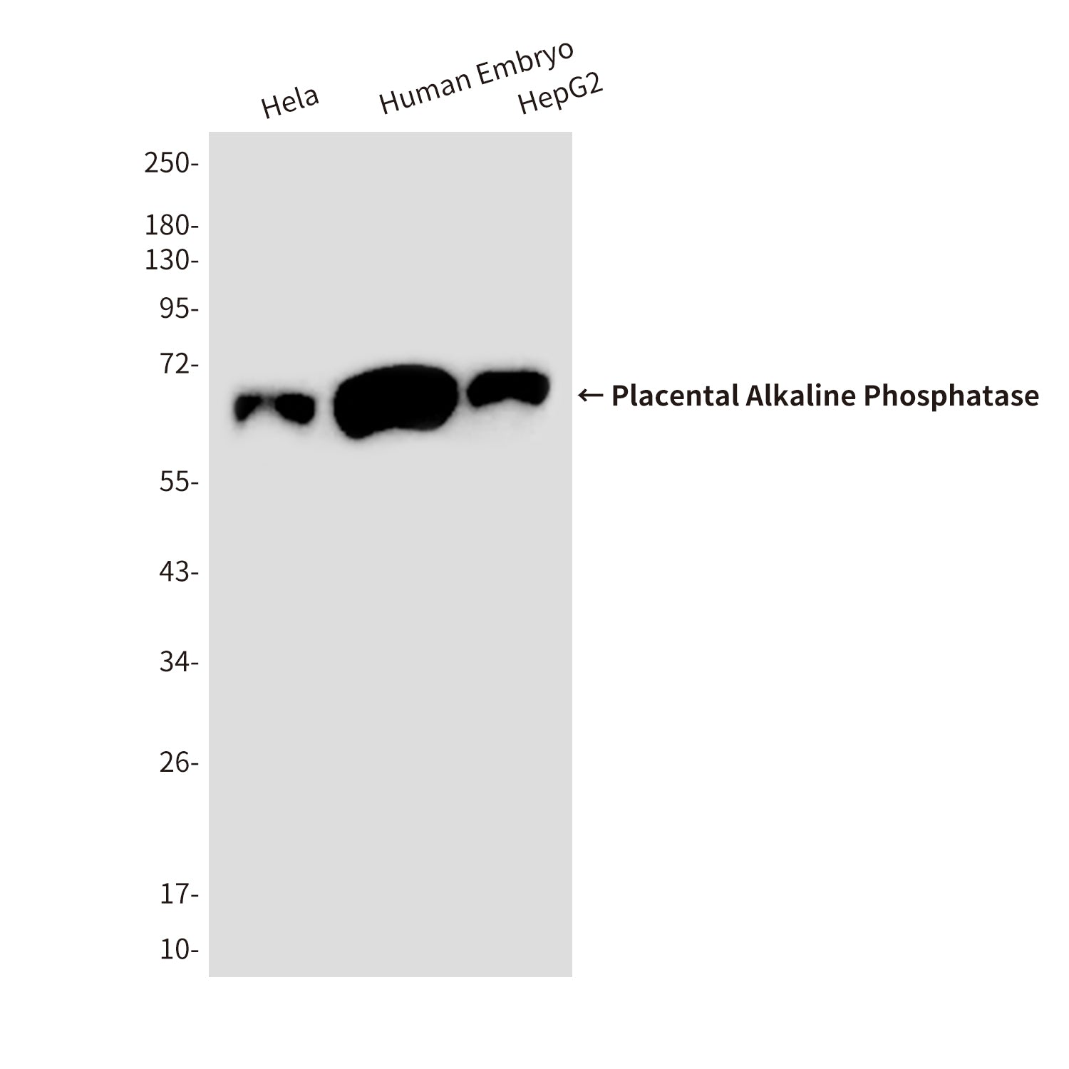 Anti-Placental Alkaline Phosphatase Mouse Monoclonal Antibody