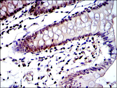 Anti-Proteasome beta 8 (3G3) Mouse Monoclonal Antibody