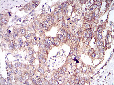Anti-GSK3 beta Mouse Monoclonal Antibody