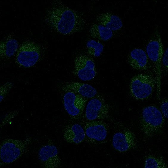 Anti-NF-KB p65 Rabbit Polyclonal Antibody
