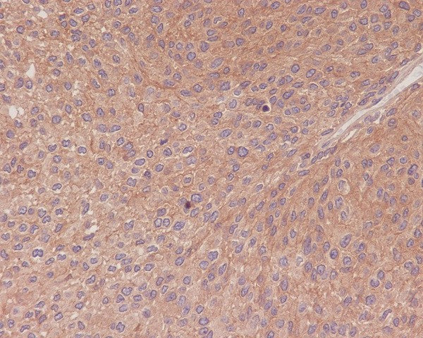 Anti-NF-KB p65 Rabbit Polyclonal Antibody