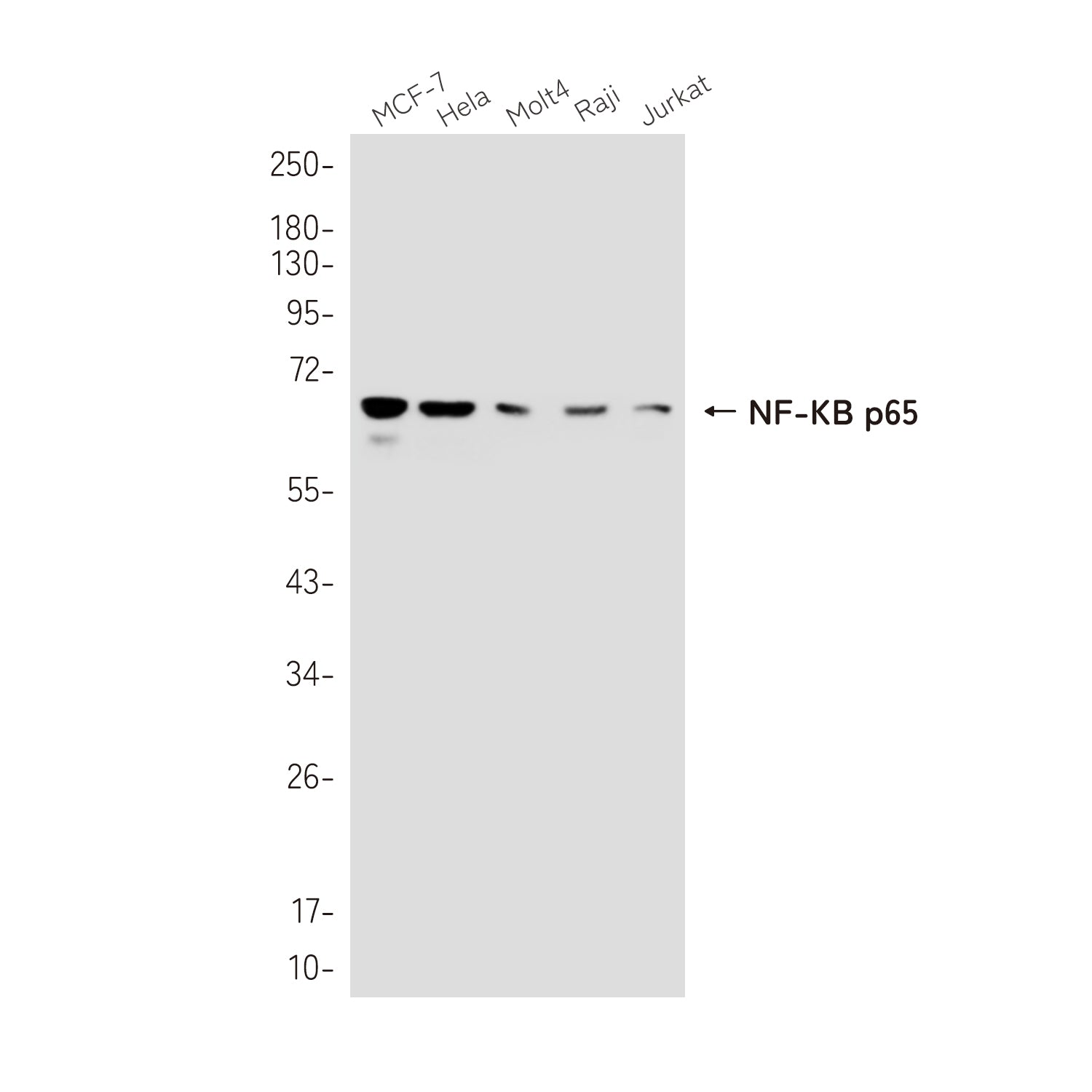 Anti-NF-KB p65 Rabbit Polyclonal Antibody