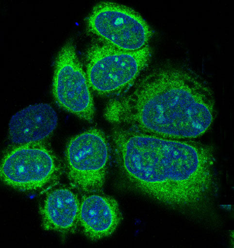 Anti-Alkaline Phosphatase Rabbit Polyclonal Antibody