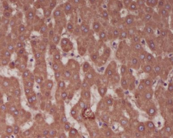 Anti-Alkaline Phosphatase Rabbit Polyclonal Antibody