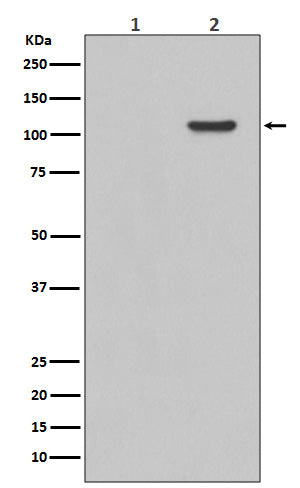 Anti-Phospho-FAK (Tyr397) Rabbit Polyclonal Antibody