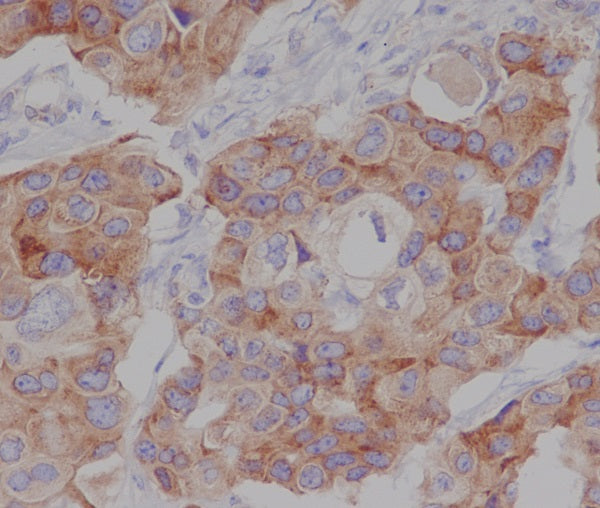 Anti-Phospho-mTOR (Ser2448) Rabbit Polyclonal Antibody