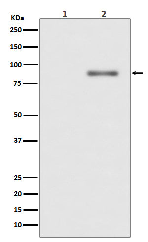 Anti-Phospho-PKC alpha (Thr638) Rabbit Polyclonal Antibody
