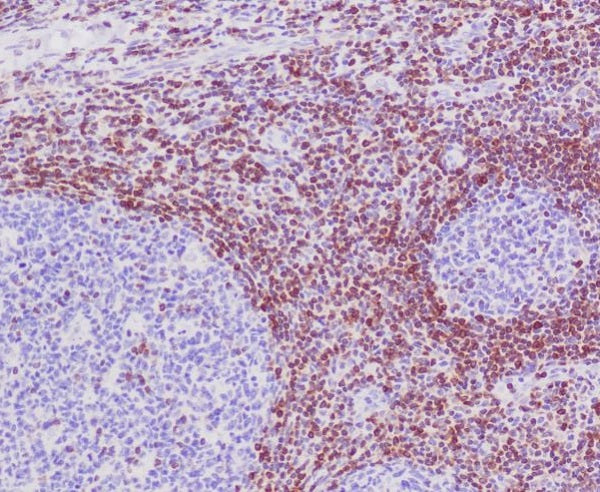 Anti-Bcl2 Rabbit Polyclonal Antibody
