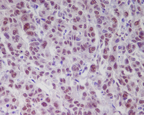 Anti-Phospho-ATM (Ser1981) Rabbit Polyclonal Antibody
