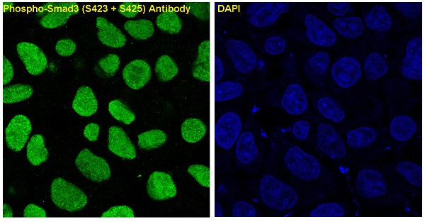 Anti-Phospho-Smad3 (Ser423/425) Rabbit Polyclonal Antibody