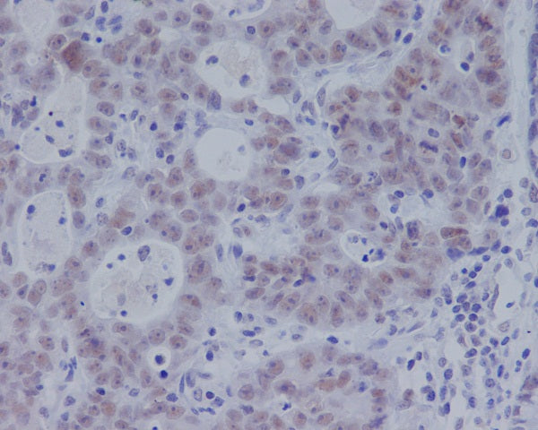 Anti-Phospho-Smad3 (Ser423/425) Rabbit Polyclonal Antibody