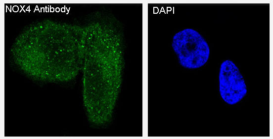 Anti-NADPH Oxidase 4 Rabbit Polyclonal Antibody